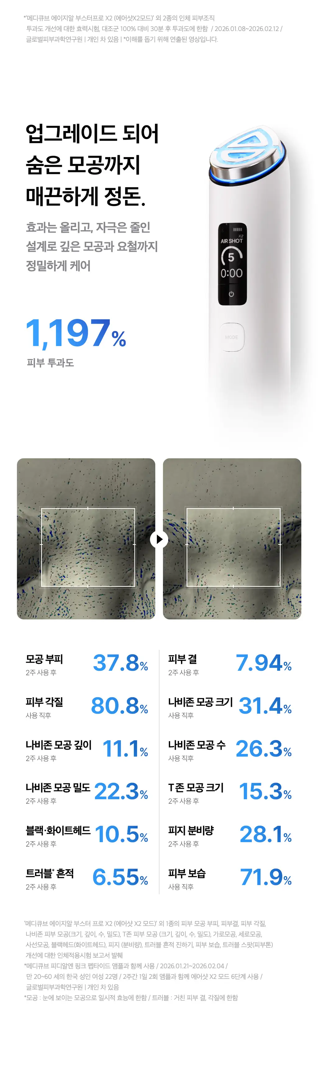 [5월올영픽] [UPGRADE] 메디큐브 에이지알 부스터 프로 X2 (핑크/화이트) 상세페이지 40